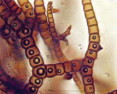 Ophiocapnocoma batistae