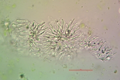 Lecanora laxa
