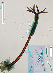 Cryptophiale udagawae