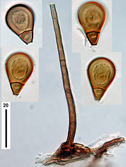 Endophragmiella boewei