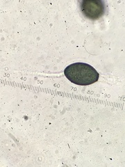 Podospora setosa