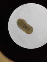 Acanthochitona crinita