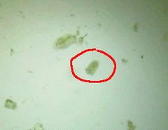Oligostraca