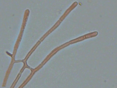Dacrymyces variisporus
