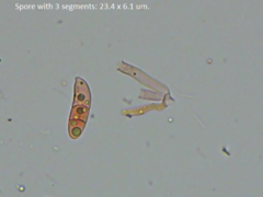 Dacrymyces variisporus