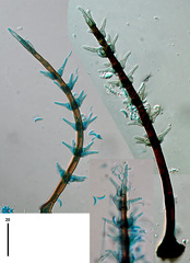 Brachiampulla verticillata