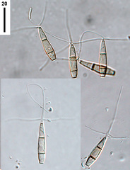 Chaetendophragmia