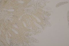 Octospora musci-muralis