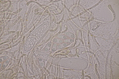 Octospora musci-muralis