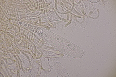 Octospora musci-muralis