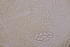 Octospora musci-muralis