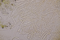 Octospora musci-muralis