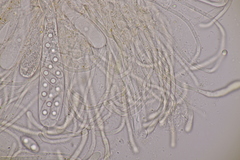 Octospora musci-muralis