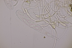 Octospora musci-muralis