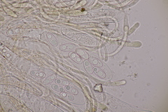 Octospora musci-muralis