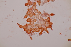 Miricatena prunicola
