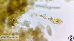 Dexiotricha colpidiopsis