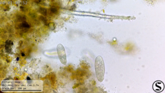 Dexiotricha colpidiopsis