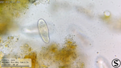 Dexiotricha colpidiopsis