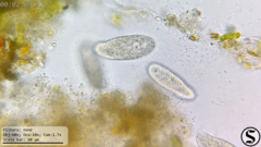 Dexiotricha colpidiopsis