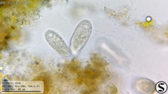 Dexiotricha colpidiopsis