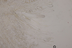Octosporopsis nicolai