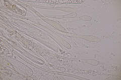 Octosporopsis nicolai