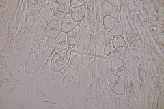 Octosporopsis nicolai