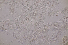 Octosporopsis nicolai