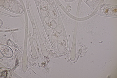 Octosporopsis nicolai