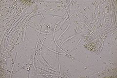 Cyclaneusma niveum