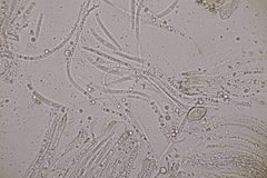 Cyclaneusma niveum