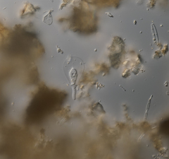 Hyalosphenia