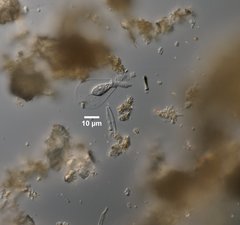 Hyalosphenia