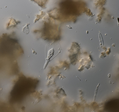 Hyalosphenia