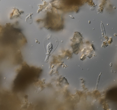 Hyalosphenia