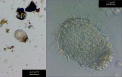 Euglypha strigosa