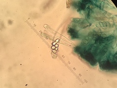 Mniaecia jungermanniae