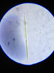 Gonatozygon brebissonii