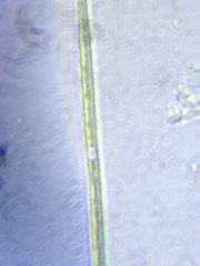 Gonatozygon brebissonii