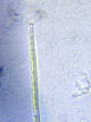 Gonatozygon brebissonii