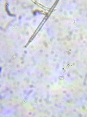 Gonatozygon brebissonii