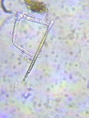 Gonatozygon brebissonii