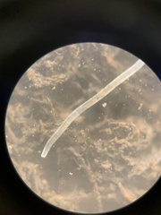 Nematoda