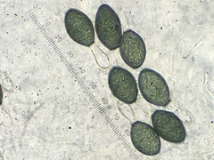 Podospora setosa