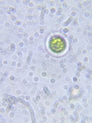 Vitreochlamys