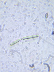 Synechococcus