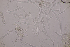 Calycellina punctata