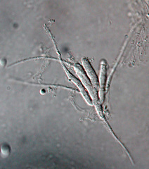Tetracladium setigerum