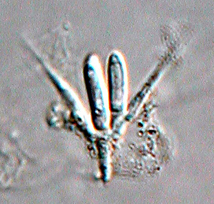 Tetracladium maxilliforme